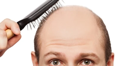 bald man brushing his remaining hair