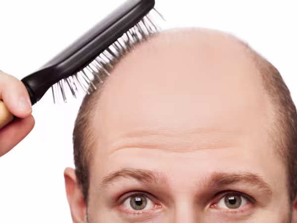 bald man brushing his remaining hair